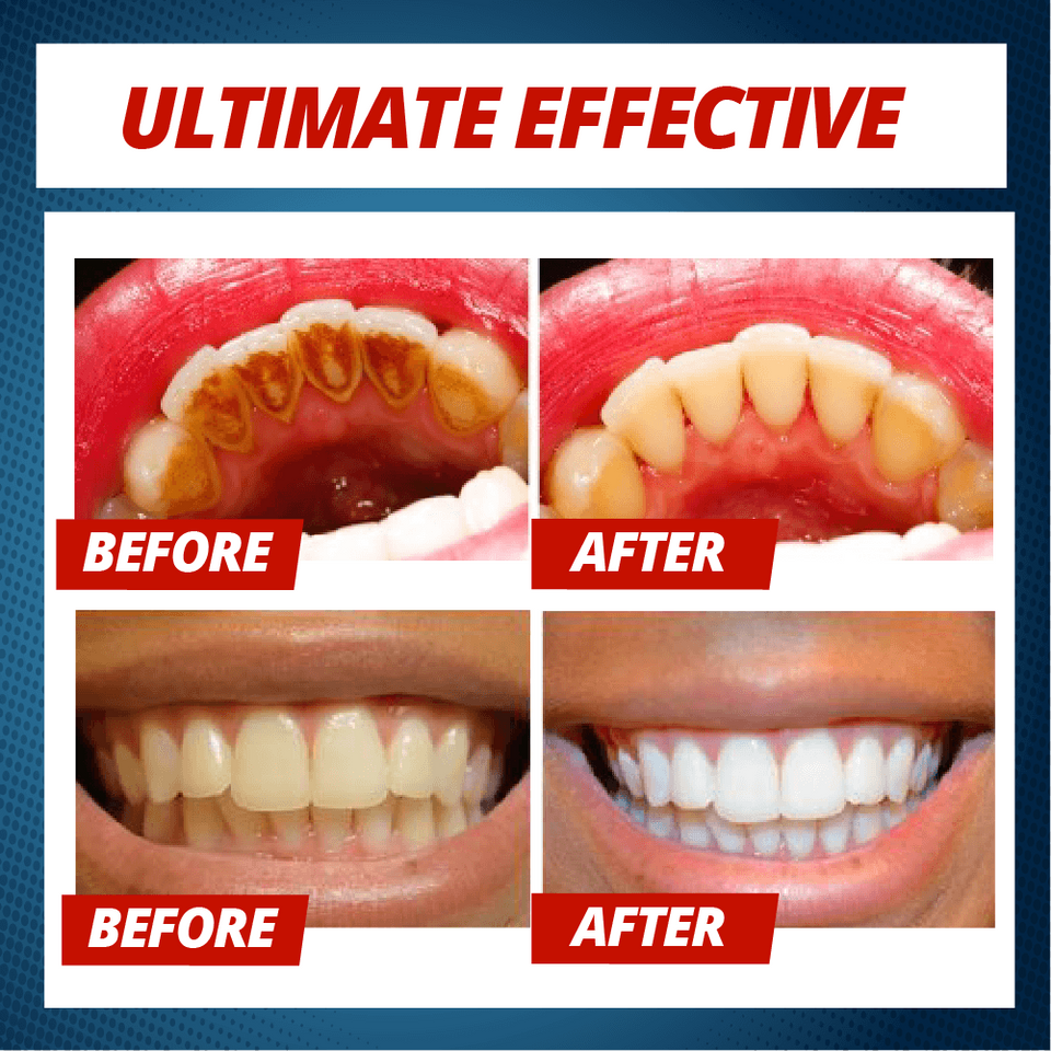 Intensive Stain Removal Whitening Toothpaste