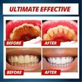 Intensive Stain Removal Whitening Toothpaste