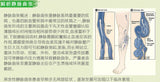 Traditional Chinese Medicine Varicose Veins Treatment Leg Acid Bilges Itching Earthworm Lumps Old Bad Leg Vasculitis Foot atch